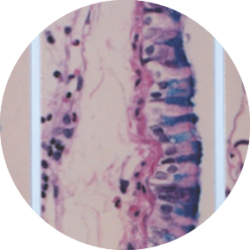 CONTROLLING THE NUMBER OF MUCUS-PRODUCING CELLS AND COPD